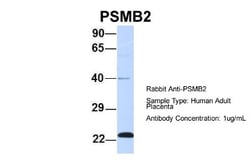 Proteasome 20S beta2 Antibody, Novus Biologicals:Antibodies:Primary Antibodies