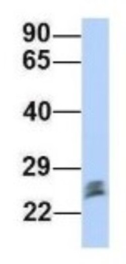 Proteasome 20S beta2 Antibody, Novus Biologicals:Antibodies:Primary Antibodies