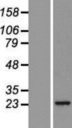 Novus Biologicals&trade;&nbsp;Proteasome 20S beta2 Overexpression Lysate
