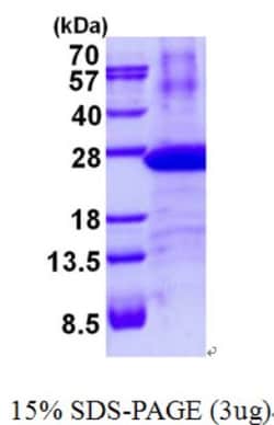 Novus Biologicals&trade;&nbsp;Recombinant Human LMP7/PSMB8 His Protein
