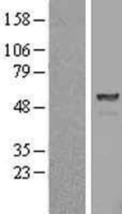 Novus Biologicals&trade;&nbsp;Proteasome 26S S5 Overexpression Lysate