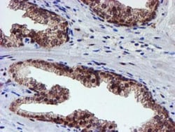Proteasome 19S 10B Antibody (OTI1G6), Novus Biologicals 0.1mL; Unlabeled:Antibodies,