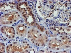 Proteasome 19S 10B Antibody (OTI1G6), Novus Biologicals 0.1mL; Unlabeled:Antibodies,