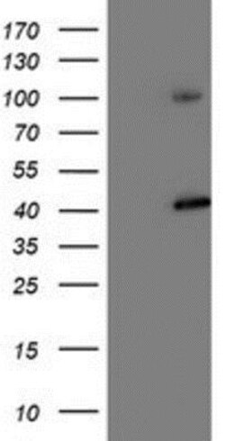 Proteasome 19S 10B Antibody (OTI1G6), Novus Biologicals 0.1mL; Unlabeled:Antibodies,