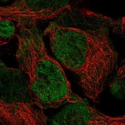 Proteasome 19S S3 Antibody, Novus Biologicals 25 &mu;L, Unlabeled:Antibodies,