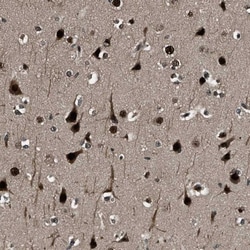 Proteasome 19S S7 Antibody, Novus Biologicals 0.1mL; Unlabeled:Antibodies,