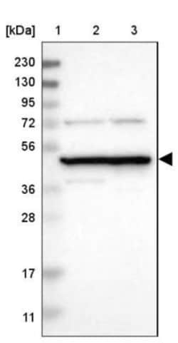 Proteasome 19S S7 Antibody, Novus Biologicals 0.1mL; Unlabeled:Antibodies,