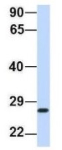 PSMA2 Antibody, Novus Biologicals 100&mu;L; Unlabeled:Antibodies, Polyclonal