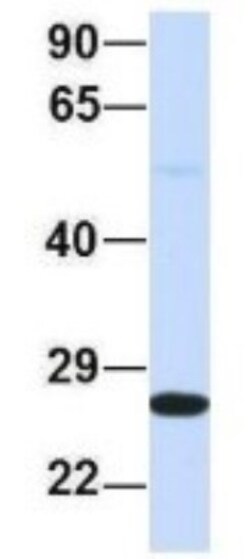 PSMA2 Antibody, Novus Biologicals 100&mu;L; Unlabeled:Antibodies, Polyclonal