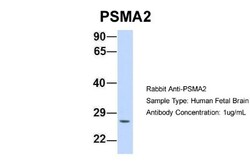 PSMA2 Antibody, Novus Biologicals 100&mu;L; Unlabeled:Antibodies, Polyclonal