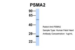 PSMA2 Antibody, Novus Biologicals 100&mu;L; Unlabeled:Antibodies, Polyclonal