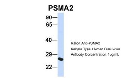 PSMA2 Antibody, Novus Biologicals 100&mu;L; Unlabeled:Antibodies, Polyclonal