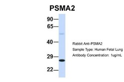 PSMA2 Antibody, Novus Biologicals 100&mu;L; Unlabeled:Antibodies, Polyclonal