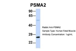 PSMA2 Antibody, Novus Biologicals 100&mu;L; Unlabeled:Antibodies, Polyclonal