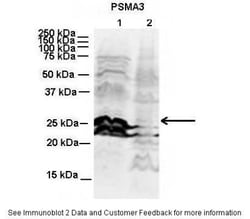 Proteasome 20S alpha 3 Antibody, Novus Biologicals 100&mu;L; Unlabeled:Antibodies,