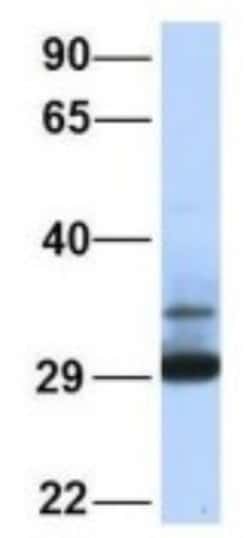Proteasome 20S alpha 3 Antibody, Novus Biologicals 100&mu;L; Unlabeled:Antibodies,