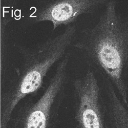 Proteasome 20S alpha 5 Antibody, Novus Biologicals 0.1mg; Unlabeled:Antibodies,
