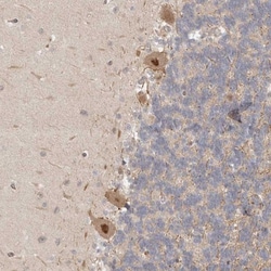 Proteasome 20S alpha 5 Antibody, Novus Biologicals 0.1mL; Unlabeled:Antibodies,