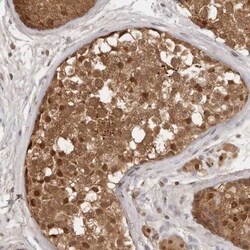 USP1 Antibody, Novus Biologicals:Antibodies:Primary Antibodies