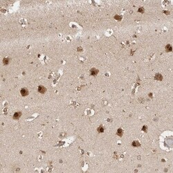 Pyruvate Dehydrogenase Kinase 1/PDK1 Antibody, Novus Biologicals:Antibodies:Primary