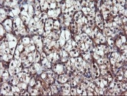 Proteasome 20S alpha 6 Antibody (OTI3B8), Novus Biologicals 0.1 mL | Buy Online | Novus Biologicals | Fisher Scientific