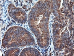 Proteasome 20S alpha 6 Antibody (OTI3B8), Novus Biologicals 0.1 mL | Buy Online | Novus Biologicals | Fisher Scientific