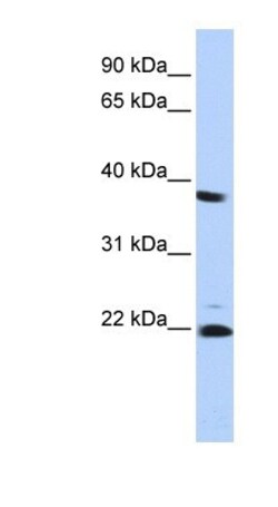 Proteasome 20S beta2 Antibody, Novus Biologicals:Antibodies:Primary Antibodies