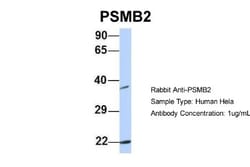 Proteasome 20S beta2 Antibody, Novus Biologicals:Antibodies:Primary Antibodies