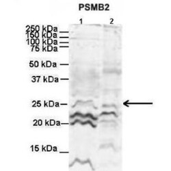 Proteasome 20S beta2 Antibody, Novus Biologicals:Antibodies:Primary Antibodies