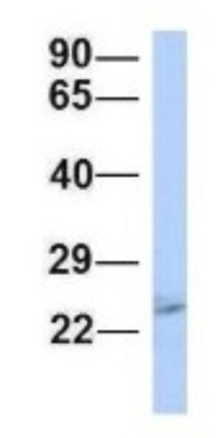 Proteasome 20S beta2 Antibody, Novus Biologicals:Antibodies:Primary Antibodies