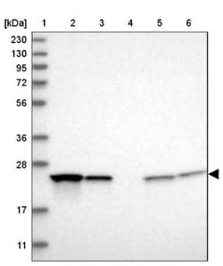 Proteasome 20S beta2 Antibody, Novus Biologicals 0.1mL; Unlabeled:Antibodies,