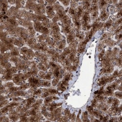 Proteasome 20S beta 6 Antibody, Novus Biologicals:Antibodies:Primary Antibodies