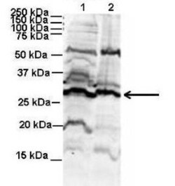 Proteasome 20S beta 6 Antibody, Novus Biologicals:Antibodies:Primary Antibodies