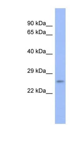Proteasome 20S beta 6 Antibody, Novus Biologicals:Antibodies:Primary Antibodies