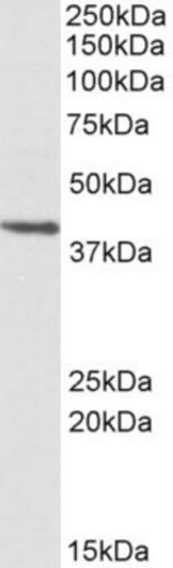 PSMB7 Antibody, Novus Biologicals 0.1mg; Unlabeled:Antibodies, Polyclonal