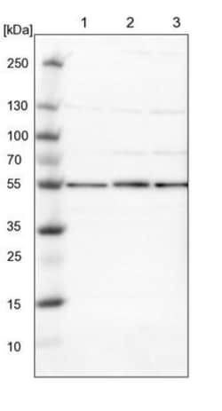 Proteasome 26S S5 Antibody, Novus Biologicals:Antibodies:Primary Antibodies