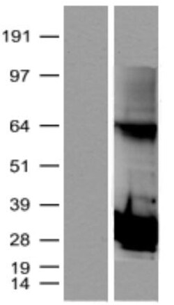 Novus Biologicals&trade;&nbsp;Proteasome subunit beta type 4 Overexpression Lysate