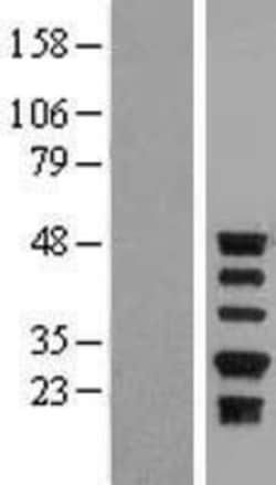 Novus Biologicals™ Serpin A5/Protein C Inhibitor Overexpression Lysate
