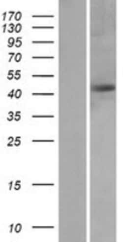 Novus Biologicals&trade;&nbsp;Protein Kinase A regulatory subunit I alpha Overexpression Lysate
