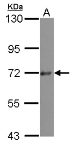 PRKD3/nPKC nu Antibody, Novus Biologicals 0.1 mL | Buy Online | Novus Biologicals | Fisher Scientific