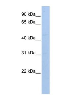 Protein mab-21-like 1 Antibody, Novus Biologicals:Antibodies:Primary Antibodies