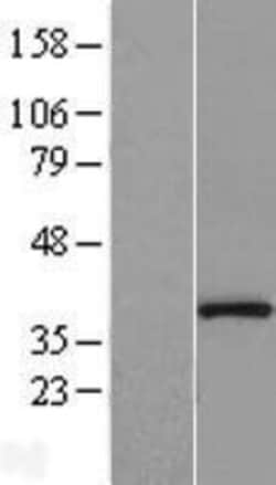 Novus Biologicals&trade;&nbsp;Protein Phosphatase 1 beta Overexpression Lysate