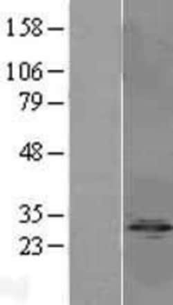 Novus Biologicals&trade;&nbsp;PP1 Inhibitor-2 Overexpression Lysate