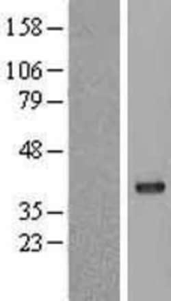 Novus Biologicals&trade;&nbsp;Protein Phosphatase 1C gamma Overexpression Lysate