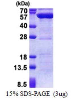 Novus Biologicals&trade;&nbsp;Recombinant Human Protein phosphatase 1F His Protein
