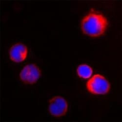Proteinase 3/Myeloblastin/PRTN3 Antibody, Novus Biologicals:Antibodies:Primary