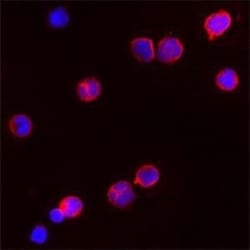 Proteinase 3/Myeloblastin/PRTN3 Antibody, Novus Biologicals:Antibodies:Primary