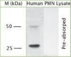 Proteinase 3/Myeloblastin/PRTN3 Antibody, Novus Biologicals:Antibodies:Primary