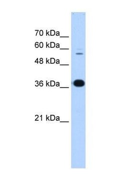 Protein Disulfide Isomerase/P4HB Antibody, Novus Biologicals 0.05mg; Unlabeled:Antibodies,