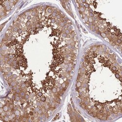 Protein Kinase A regulatory subunit I alpha Antibody, Novus Biologicals:Antibodies:Primary